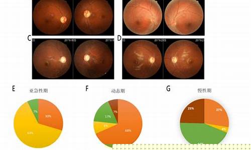 遗传性视神经病变基因检测结果解读(图1)